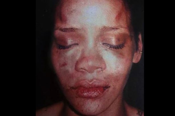 Rihanna-after-Chris-Browndd.jpg